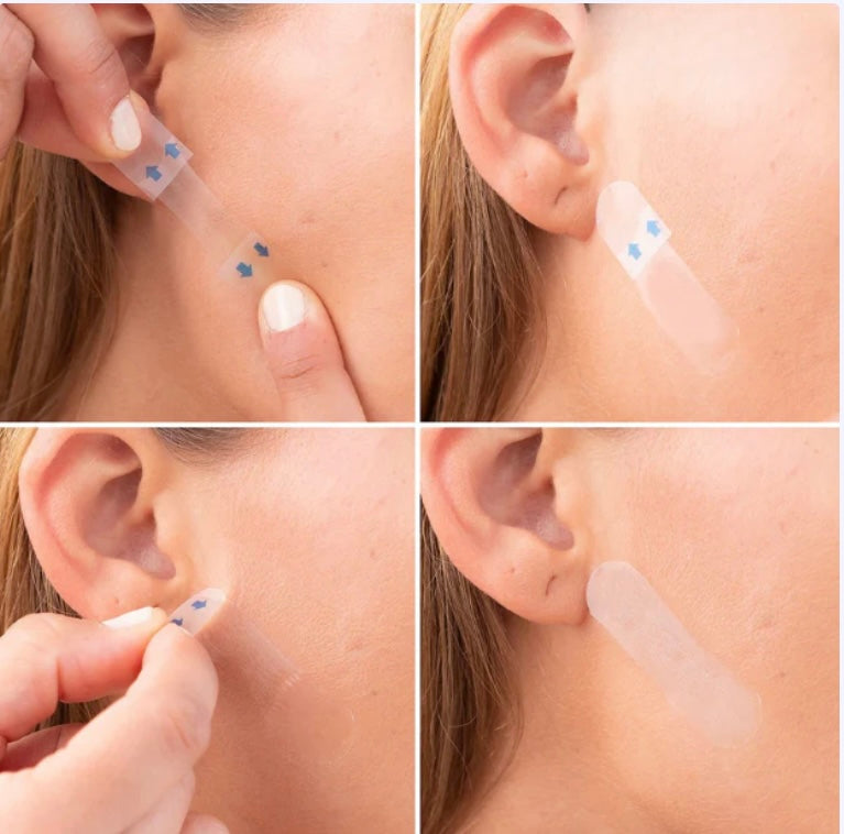 Facial Lifting Parches x40
